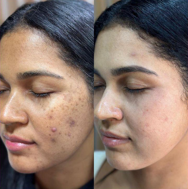Skin Repair - before and after