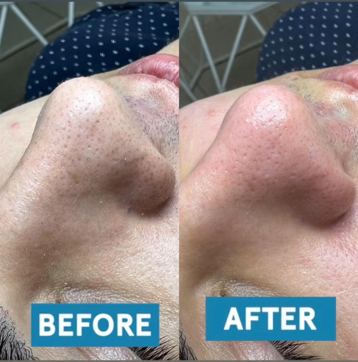 Beauty Procedure - before and after